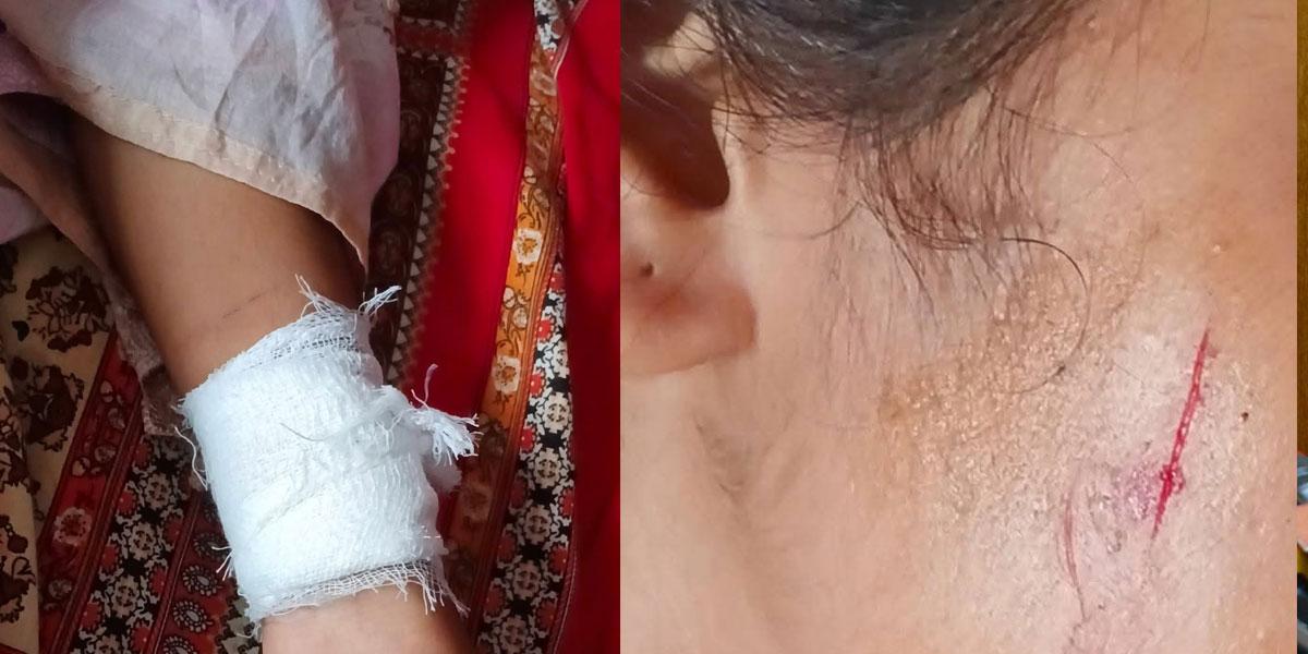 সীতাকুণ্ডে স্কুলে যাওয়ার পথে ছাত্রীকে ছুরিকাঘাত, স্বর্ণালংকার ছিনতাই
